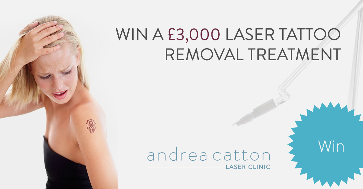 Win £3,000 Worth of PicoSure Laser Tattoo Removal ...