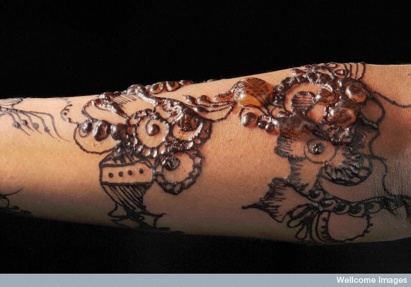 The Dangers and Side Effects of Henna Tattoos | Andrea ...