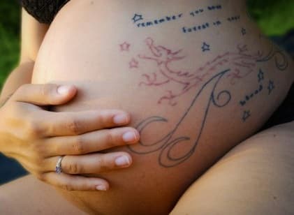 Can You Get Tattoo Removal While Pregnant? 